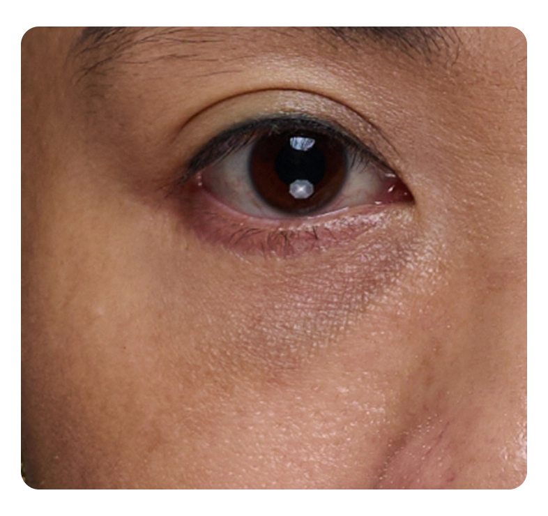 Hình ảnh minh họa