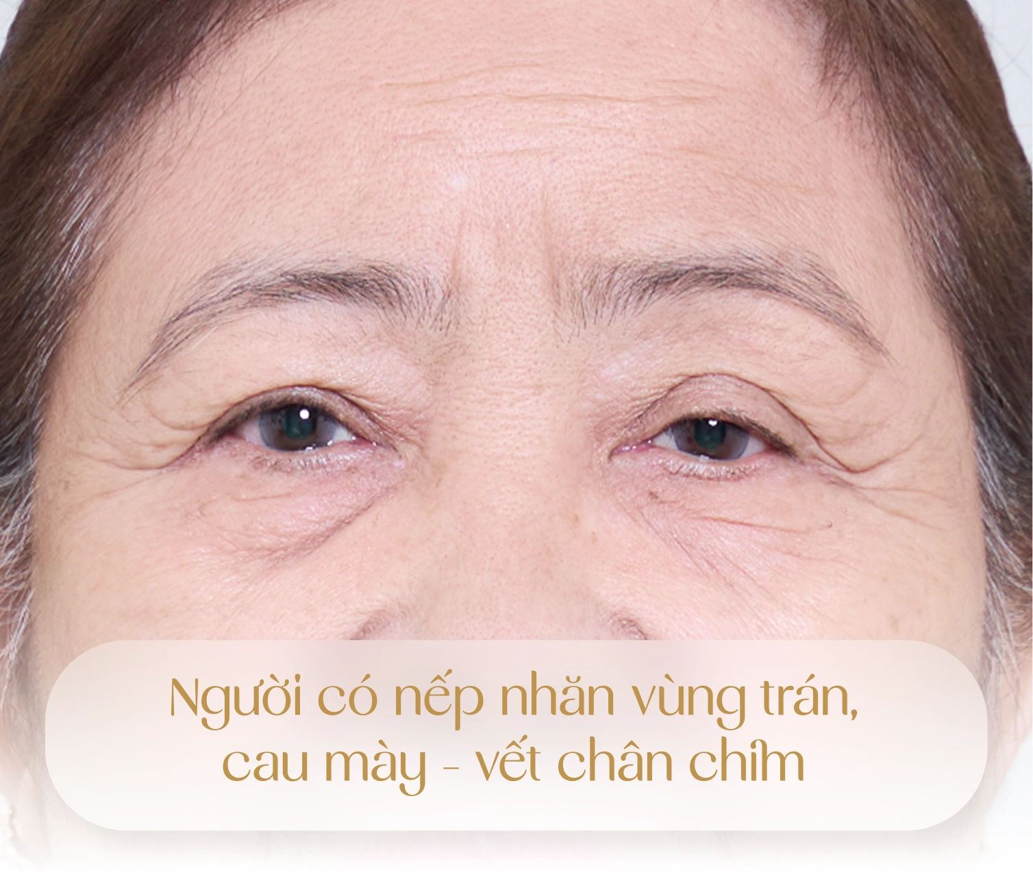 Đối tượng được chỉ định thực hiện Youthlift 1