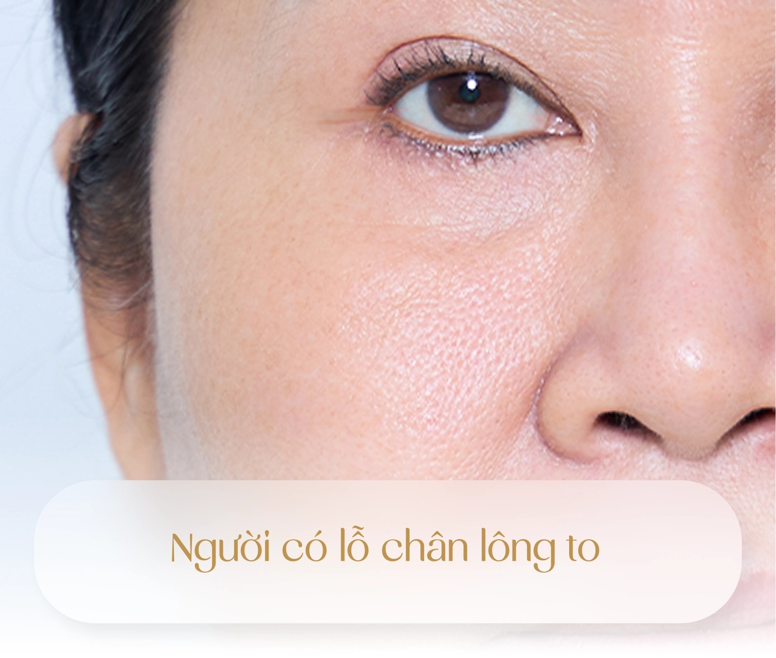 Đối tượng được chỉ định thực hiện Youthlift 2