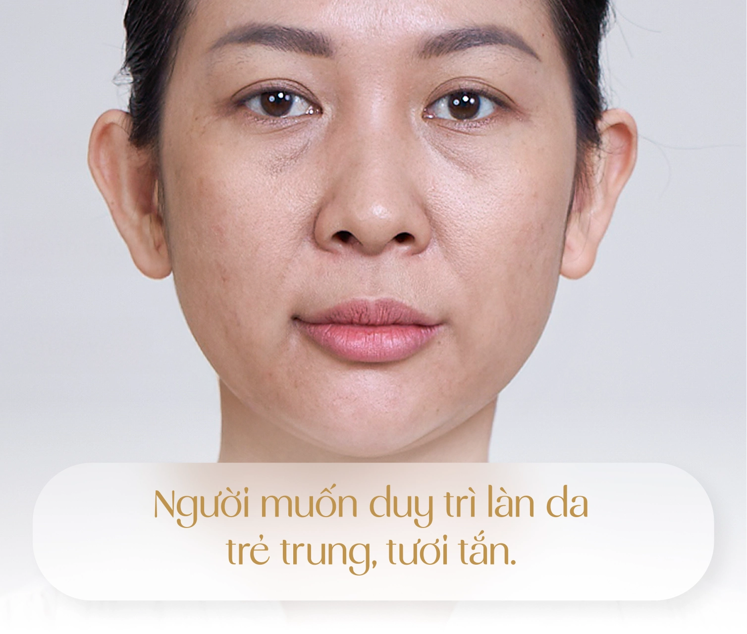 Đối tượng được chỉ định thực hiện Youthlift 3