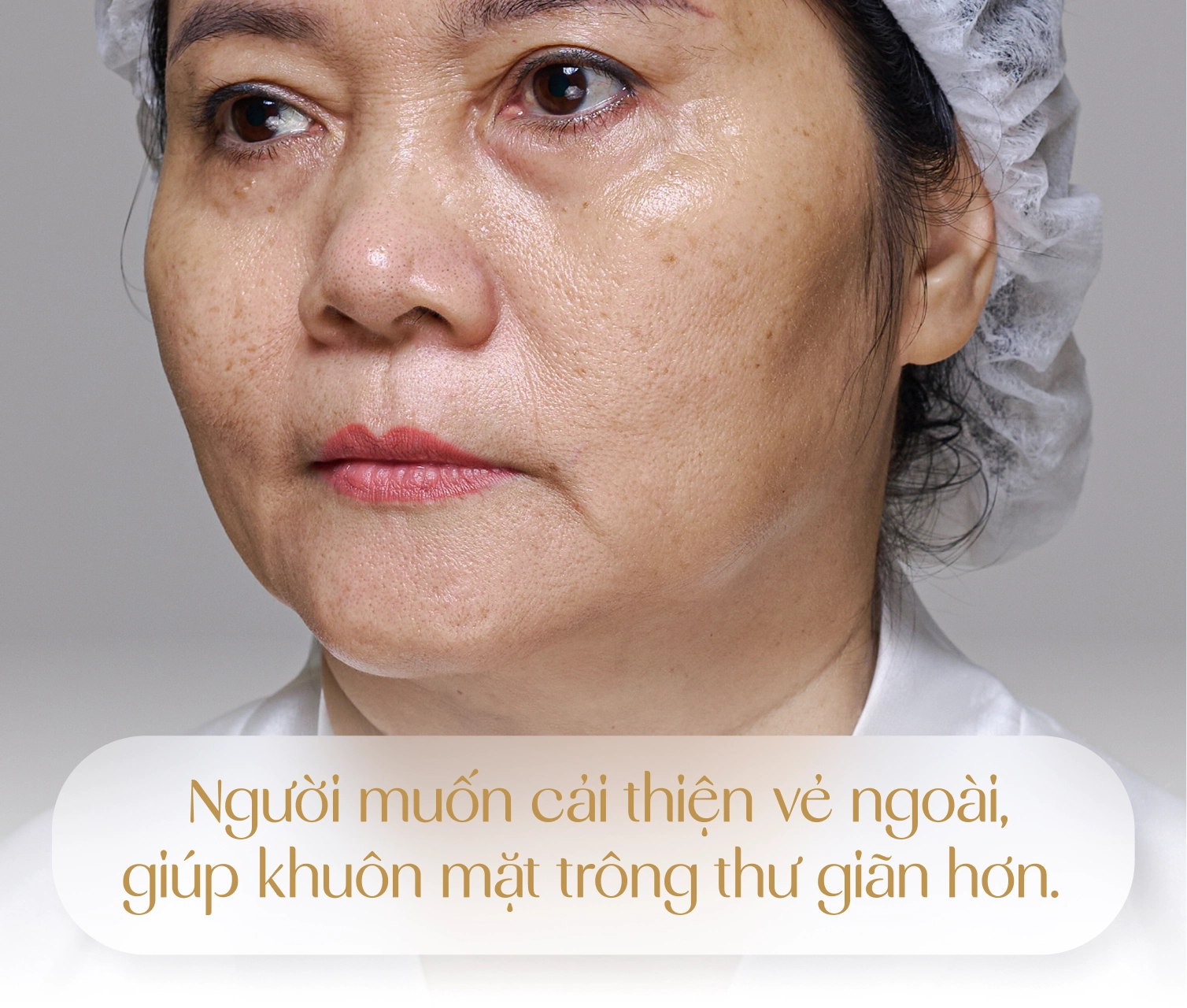 Đối tượng được chỉ định thực hiện Youthlift 4