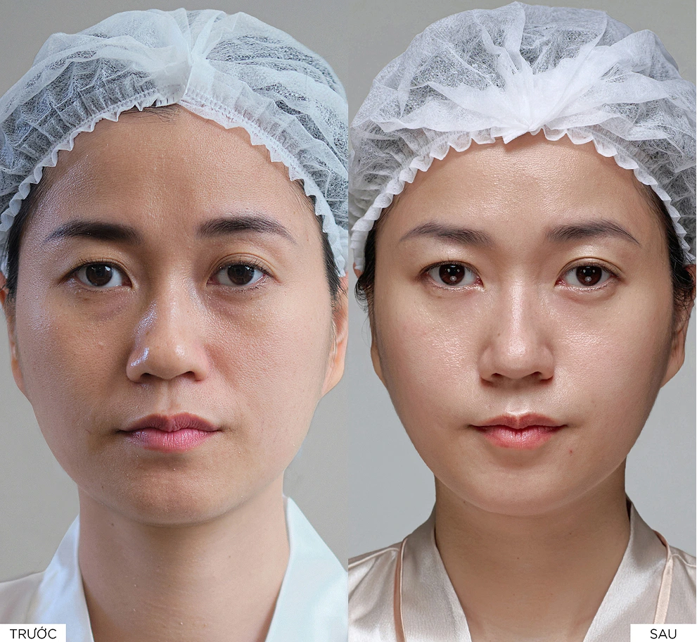 Kết quả điều trị