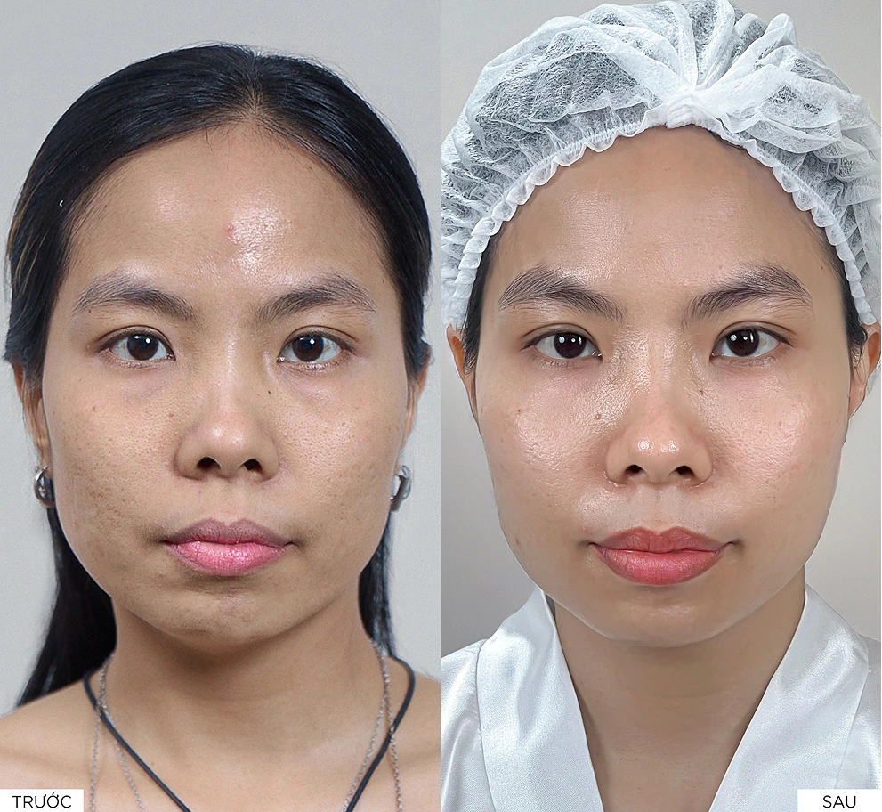 Kết quả điều trị