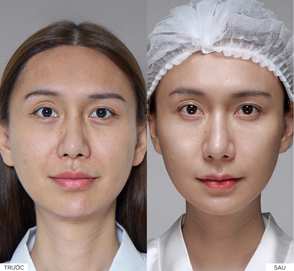 Kết quả điều trị