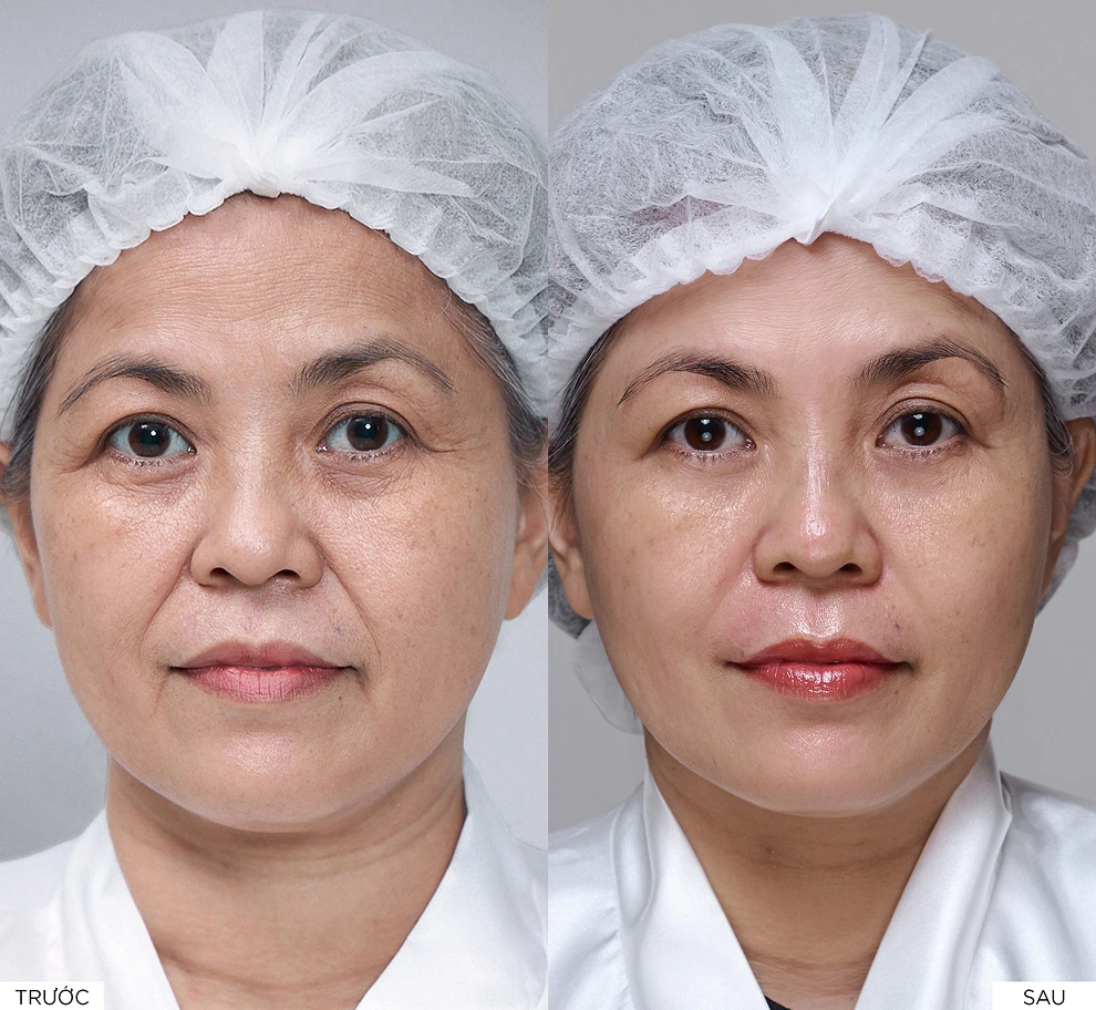 Kết quả điều trị