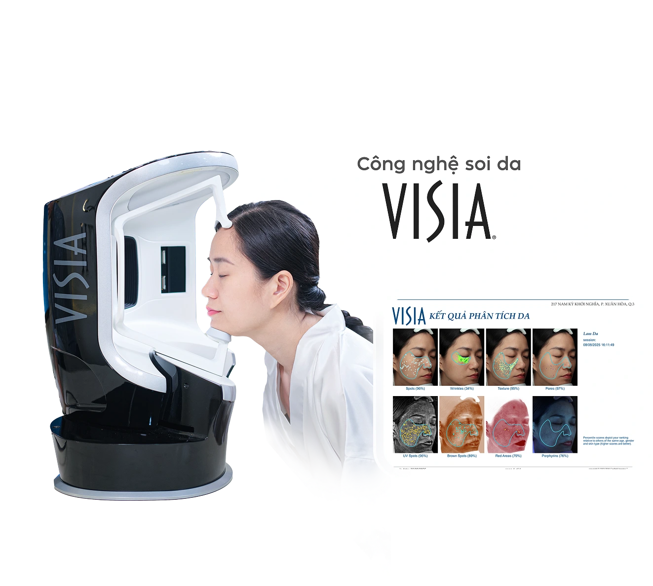 Lâm Vỹ Dạ dùng công nghệ soi da Visia