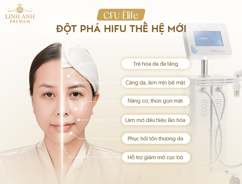 CFU có tốt không?