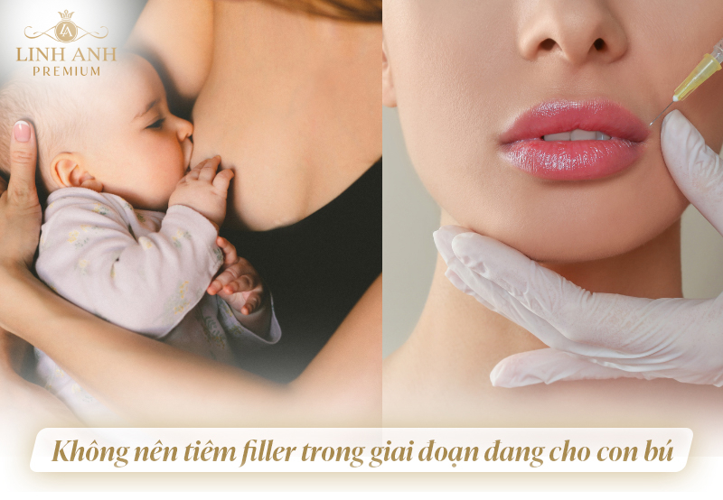 Cho con bú tiêm filler được không