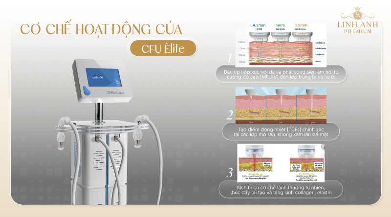 Cơ chế hoạt động CFU Èlife