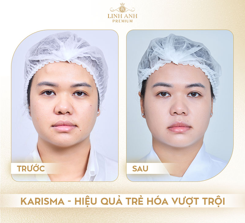Địa chỉ tiêm Karisma