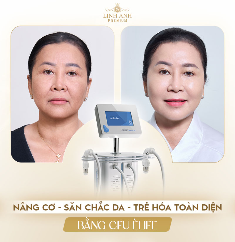 Địa chỉ trẻ hóa bằng CFU Èlife