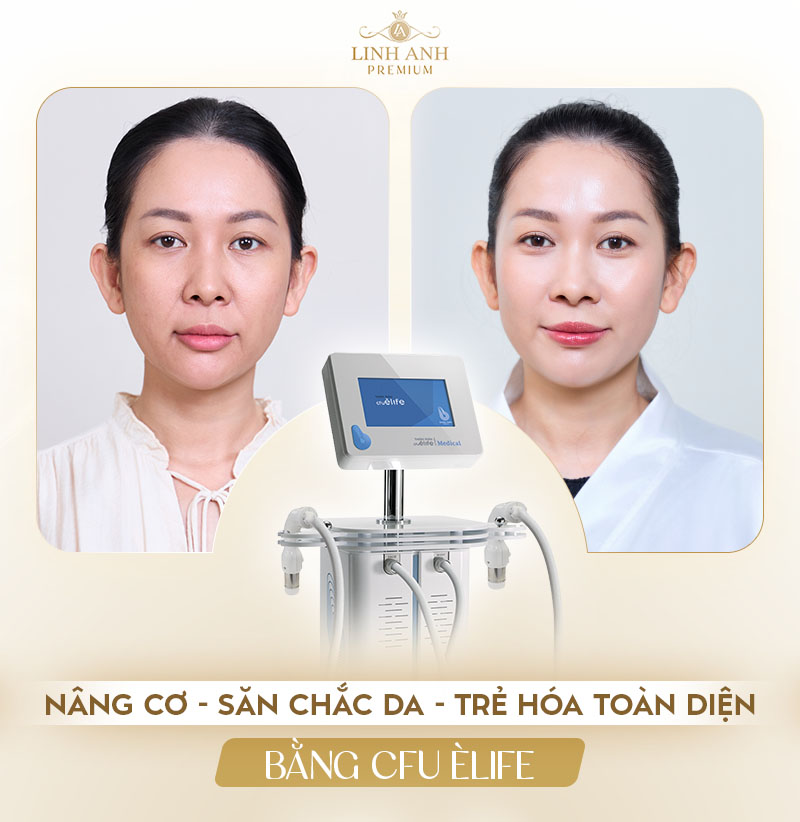 Địa chỉ trẻ hóa CFU Èlife