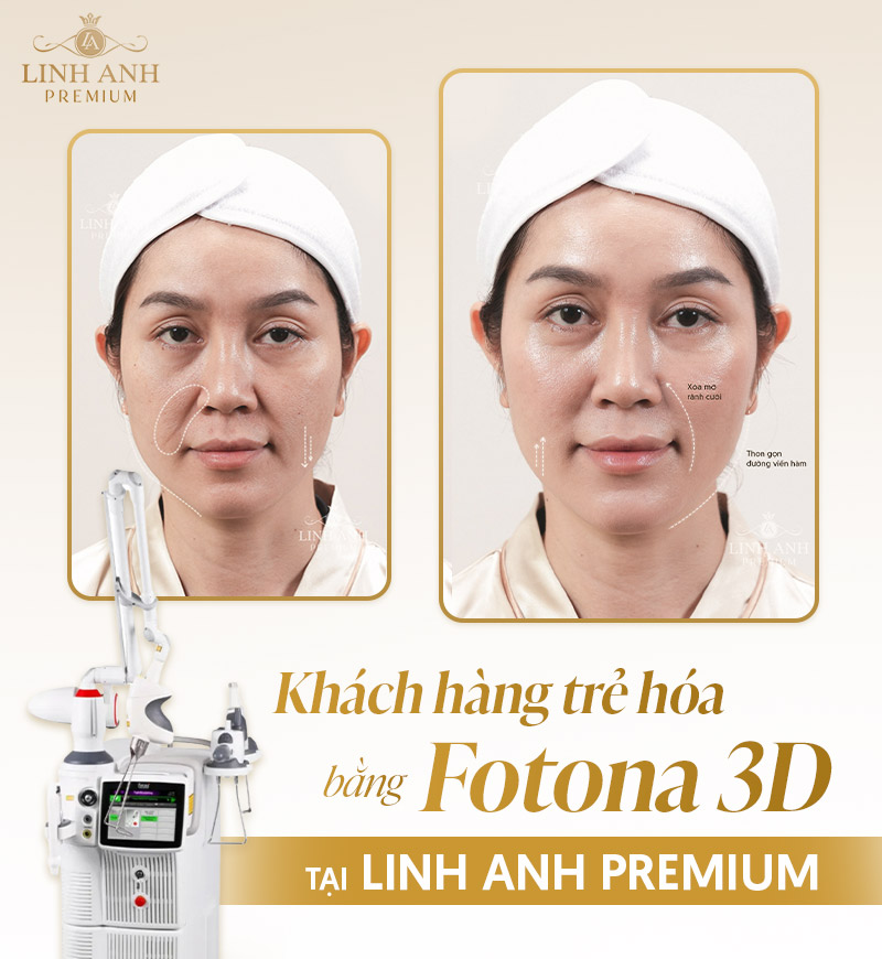 Địa chỉ trẻ hóa công nghệ cao