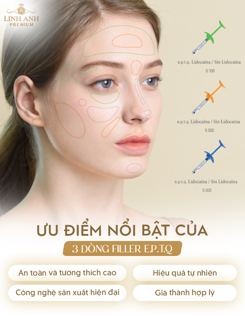 Filler eptq có tốt không