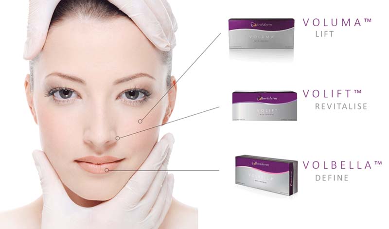 Filler Juvederm có mấy loại