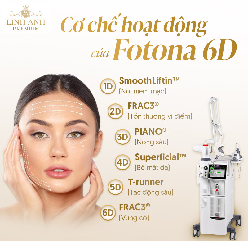 Fotona 6D hoạt động như tế nào