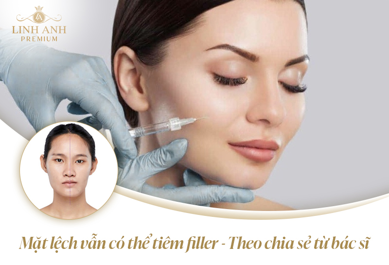 Mặt lệch có tiêm filler được không?