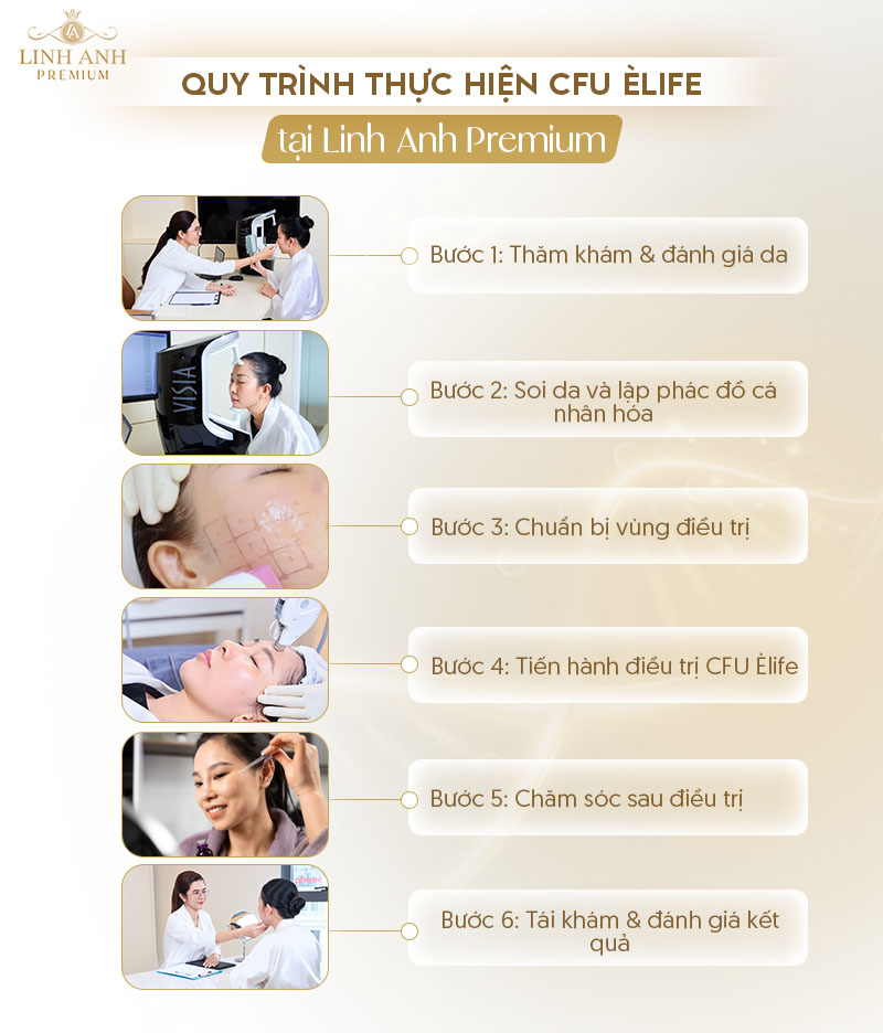 Quy trình thực hiện CFU Èlife