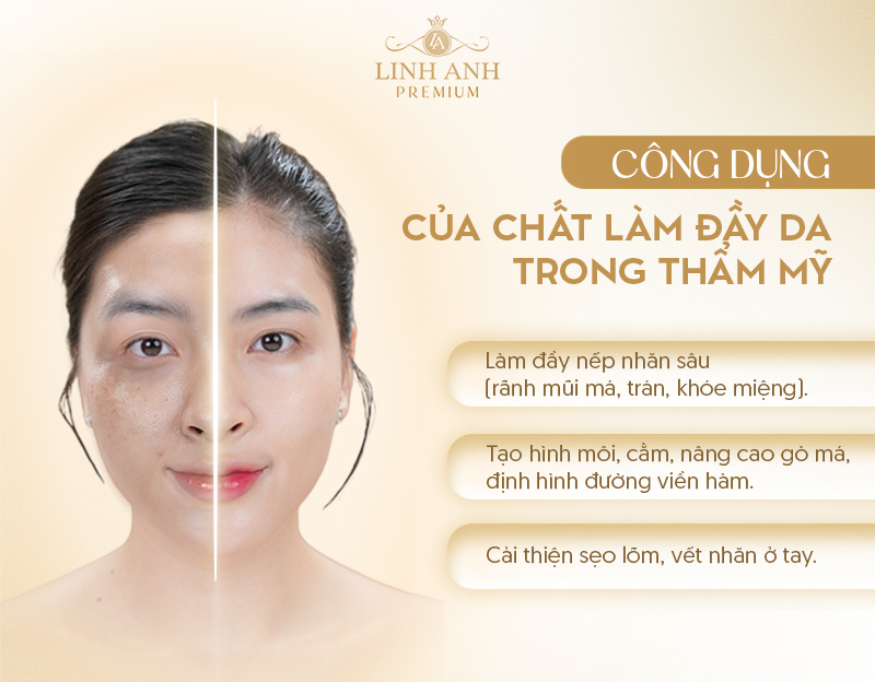 Tác dụng của chất làm đầy Tác dụng của chất làm đầy