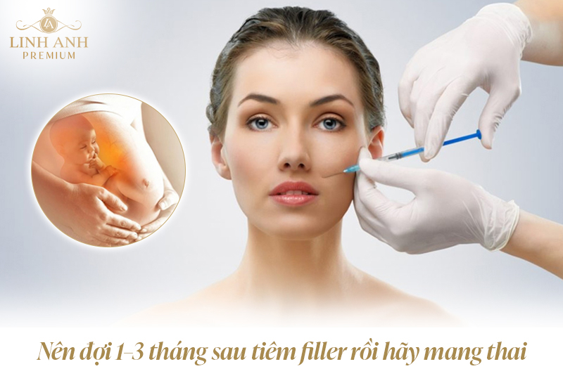 Tiêm filler bao lâu thì có bầu được? Thời điểm nào là an toàn nhất?
