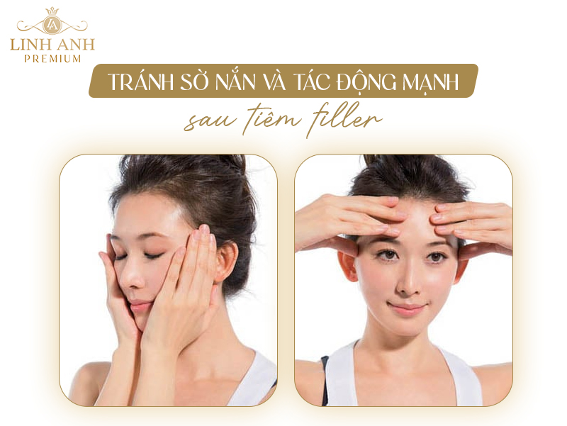 Tiêm filler cần kiêng gì