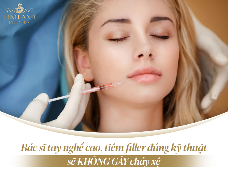 Tiêm filler có bị chảy xệ không