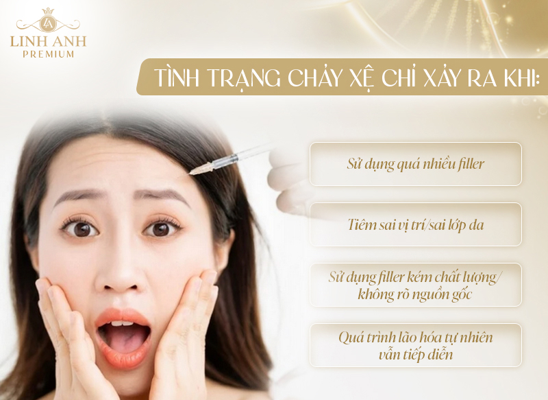 Tiêm filler có bị chảy xệ không