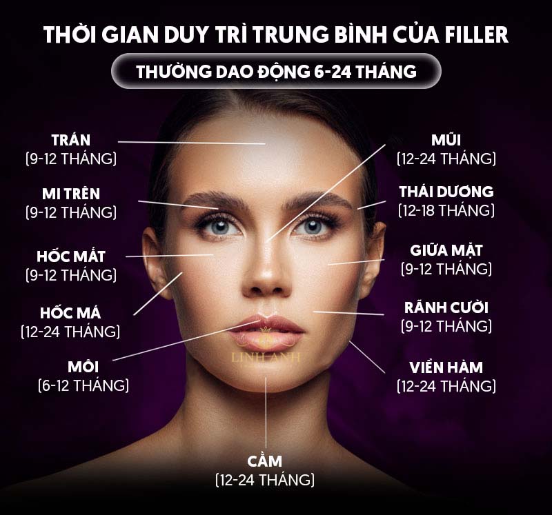 Tiêm filler được bao lâu từng vùng