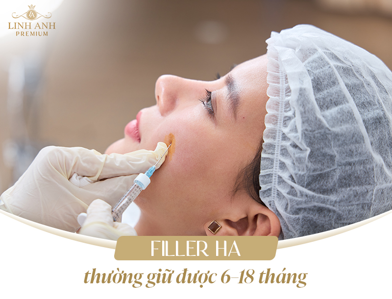 Tiêm filler giữ được bao lâu