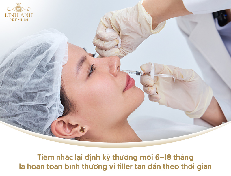 Tiêm filler nhiều lần có hại không? Tiêm filler nhiều lần có hại không?