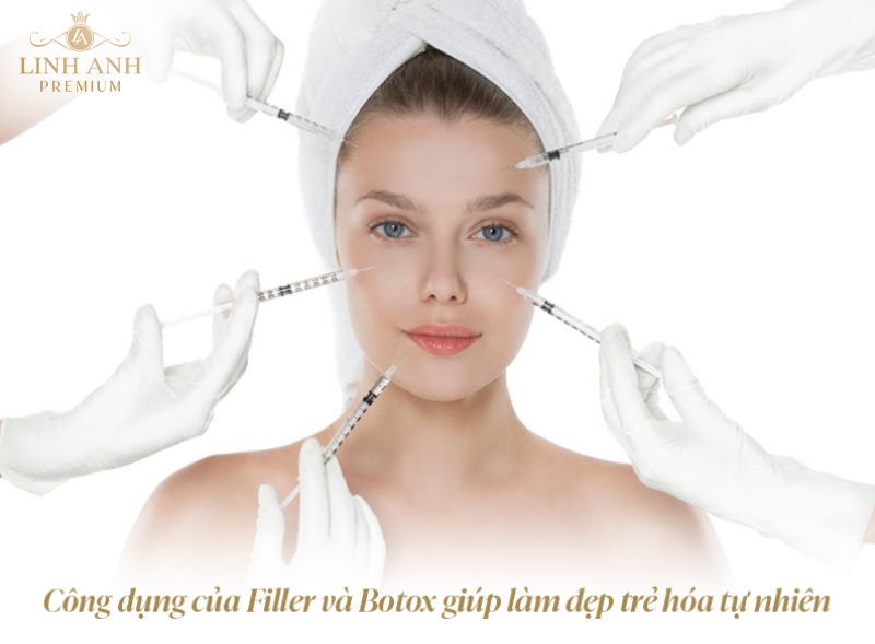 Tiêm filler và botox cái nào tốt hơn