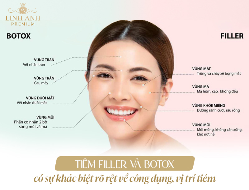 Tiêm filler và botox khác nhau như thế nào