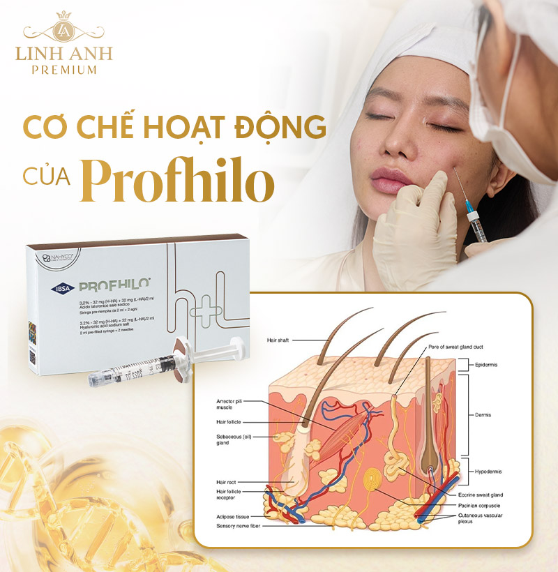 Tiêm Profhilo có tốt không