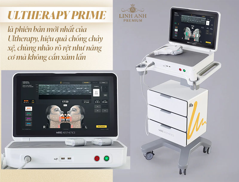 Ultherapy prime là gì?