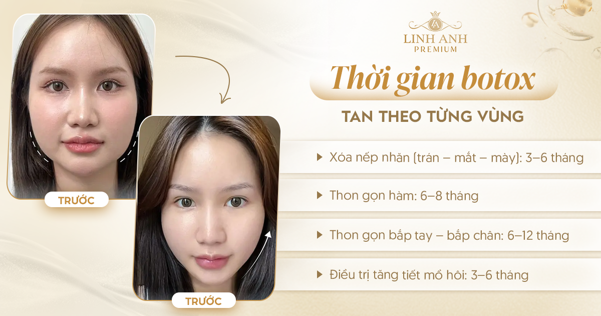 Tiêm botox bao lâu thì tan