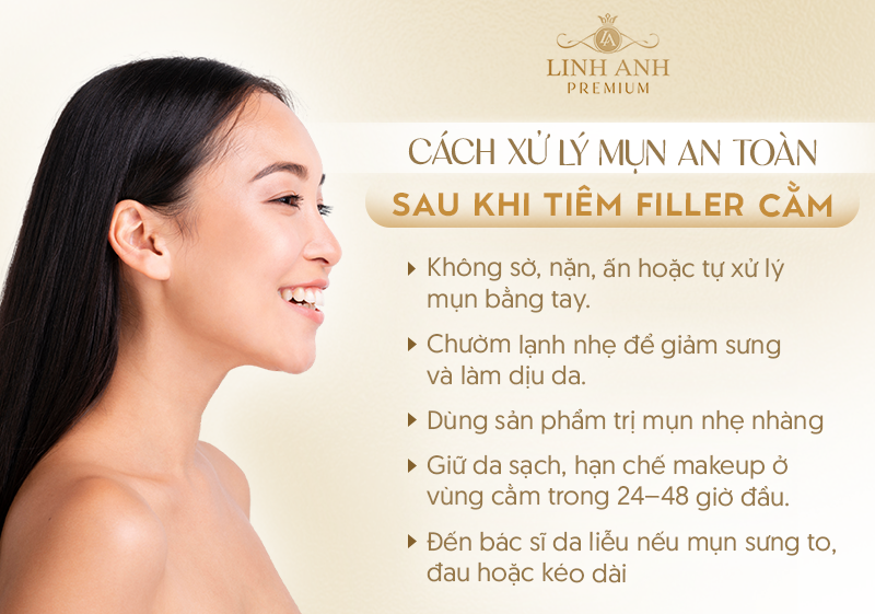 Tiêm filler bao lâu được nặn mụn