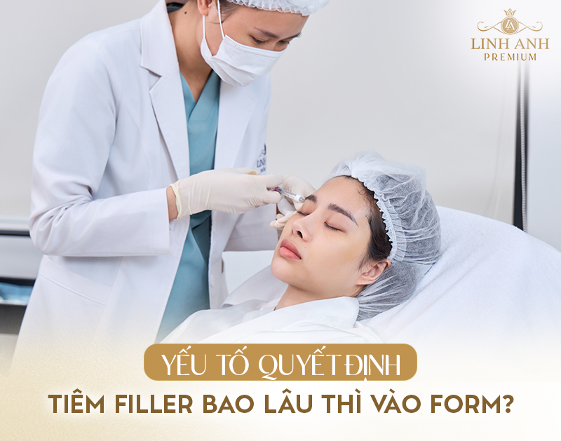 Tiêm filler bao lâu thì vào form
