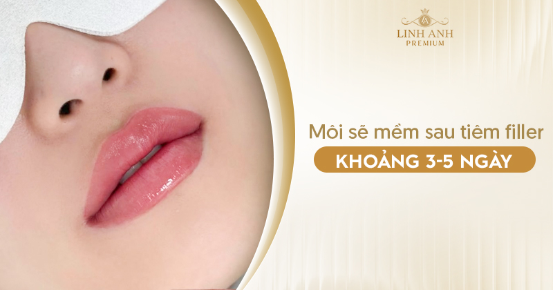 Tiêm filler môi bao lâu thì mềm