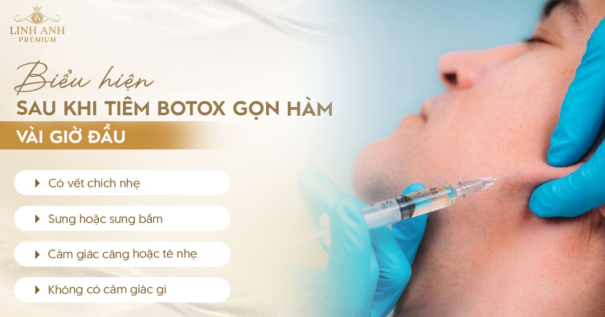 Biểu hiện sau khi tiêm botox gọn hàm