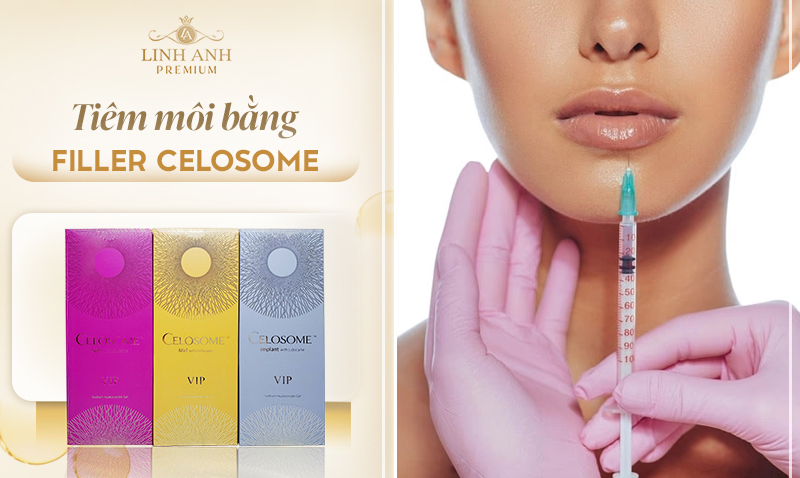 Filler Celosome có tốt không?