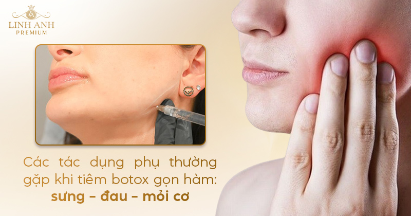 Tác hại của tiêm botox gọn hàm