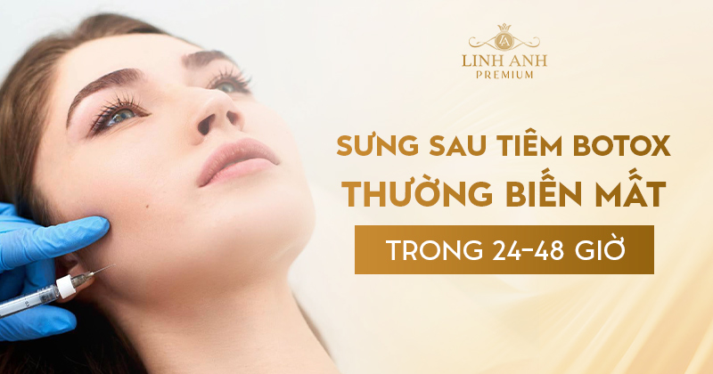 Tiêm botox bao lâu hết sưng
