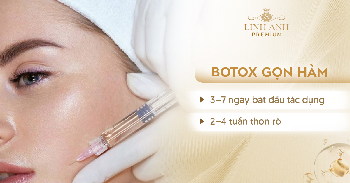 Tiêm botox gọn hàm bao lâu có tác dụng Tiêm botox gọn hàm bao lâu có tác dụng