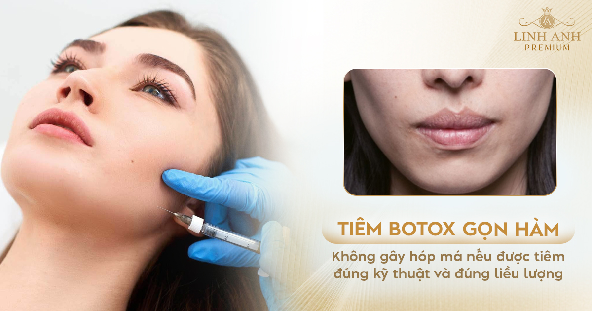 Tiêm botox gọn hàm có bị hóp má không Tiêm botox gọn hàm có bị hóp má không