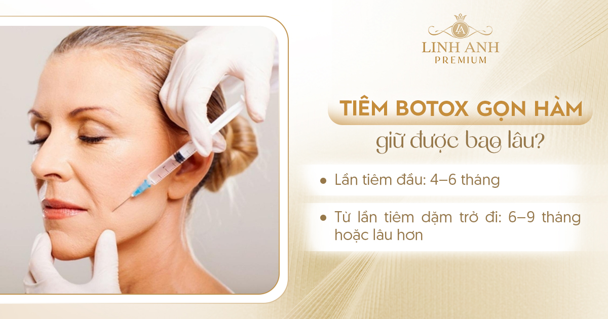 tiêm botox gọn hàm có được vĩnh viễn không