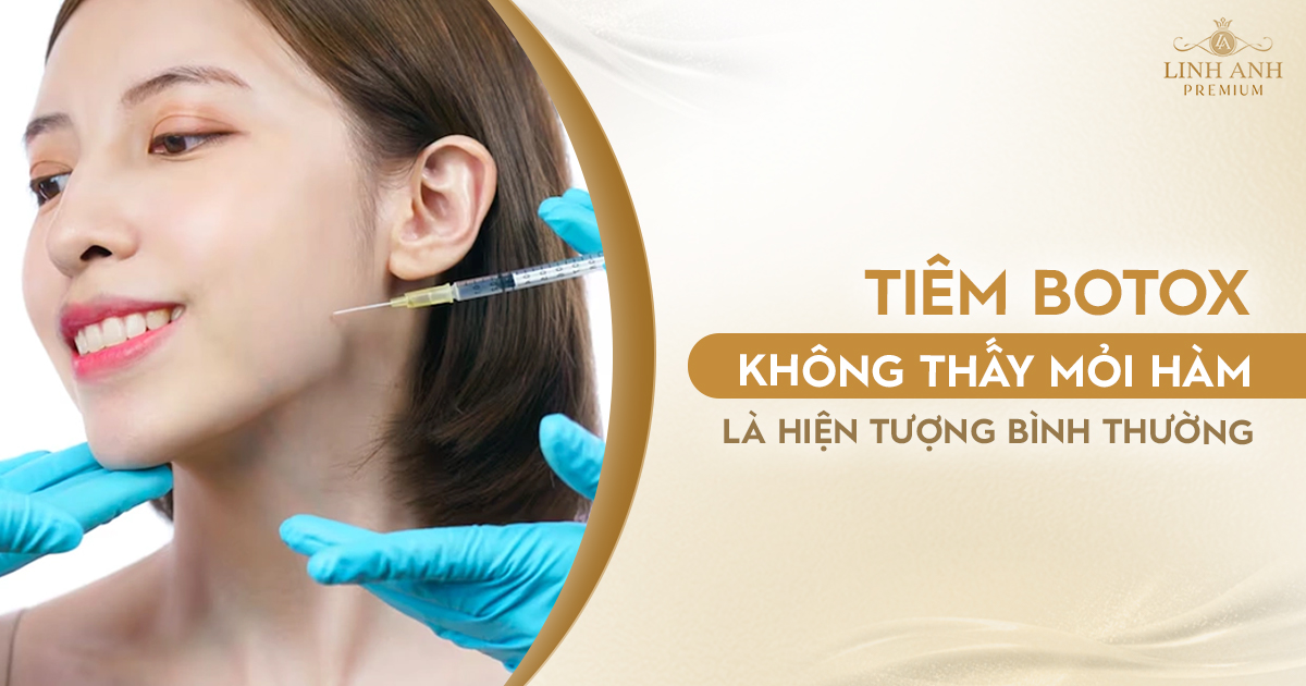 Tiêm botox không thấy mỏi hàm