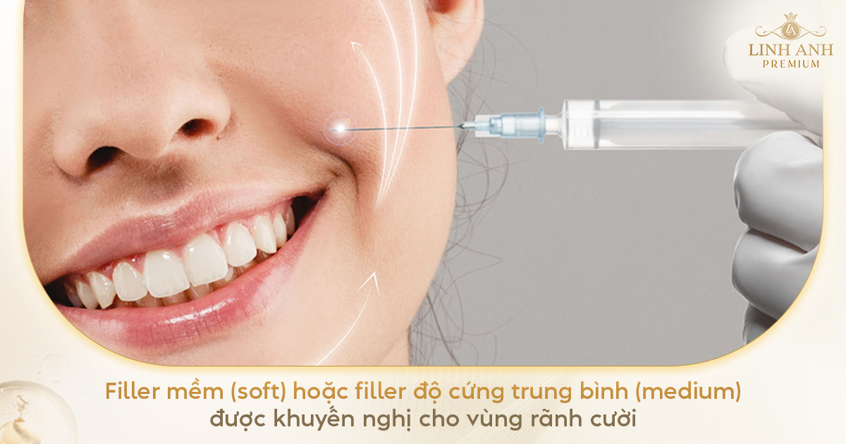 Tiêm rãnh cười bằng filler cứng hay mềm
