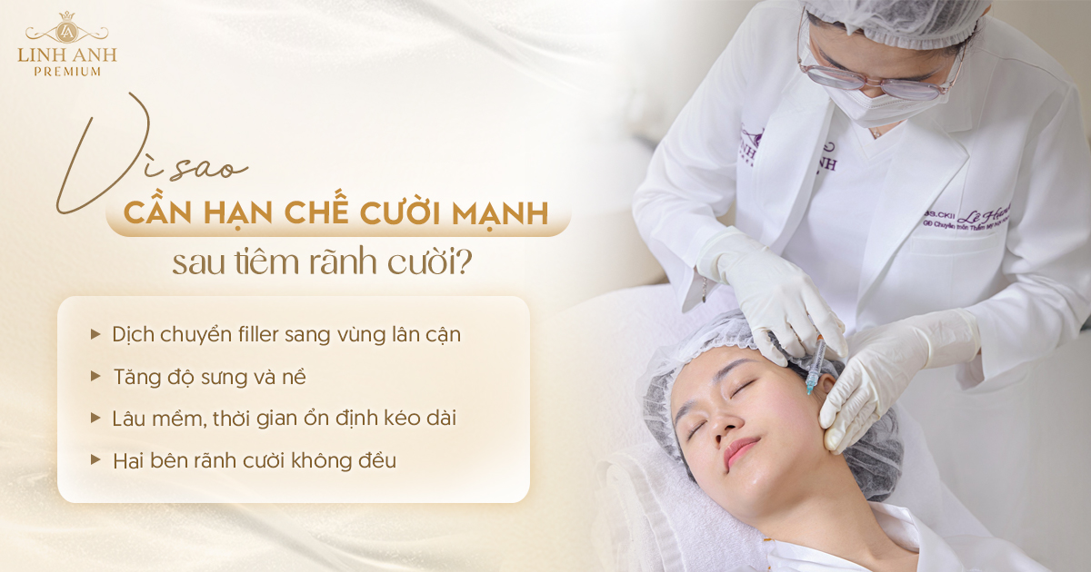 Tiêm rãnh cười có kiêng cười không