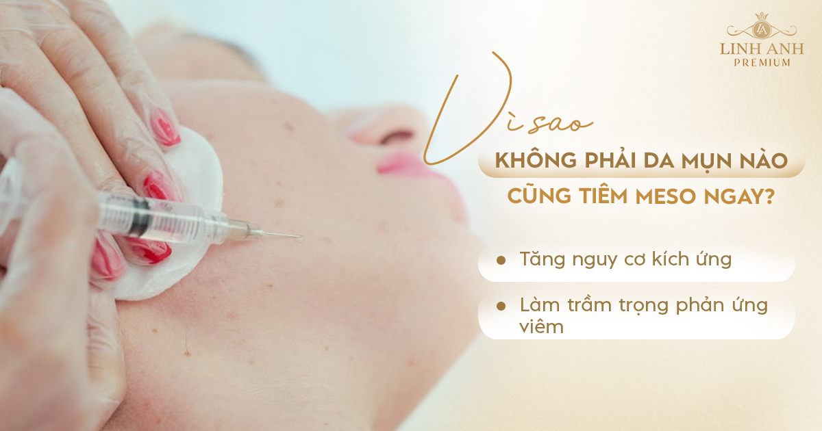 da mụn có tiêm meso được không